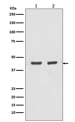 Actin (Alpha-Actin) Rabbit mAb