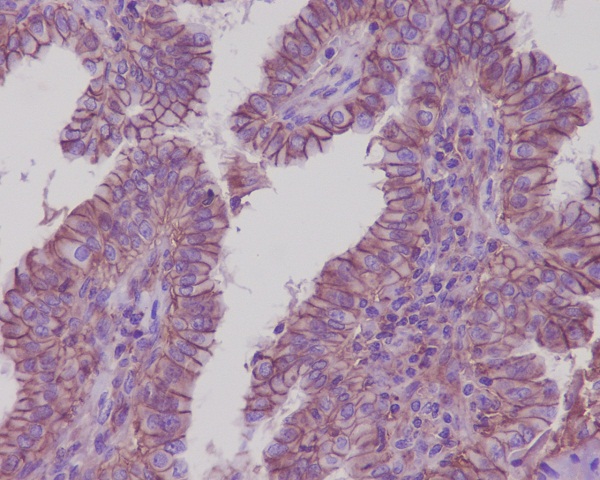 Sodium Potassium ATPase  Rabbit mAb