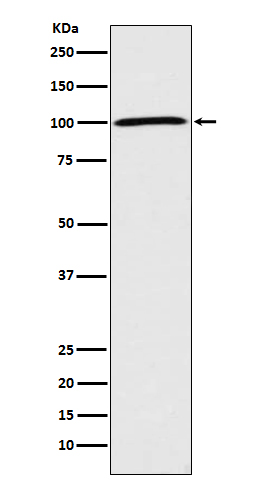 Sodium Potassium ATPase  Rabbit mAb