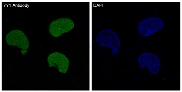 YY1 Rabbit mAb