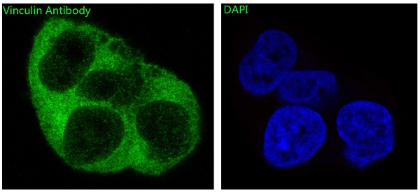 Vinculin Rabbit mAb