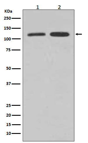 Vinculin Rabbit mAb