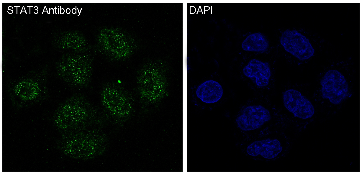 STAT3 Rabbit mAb