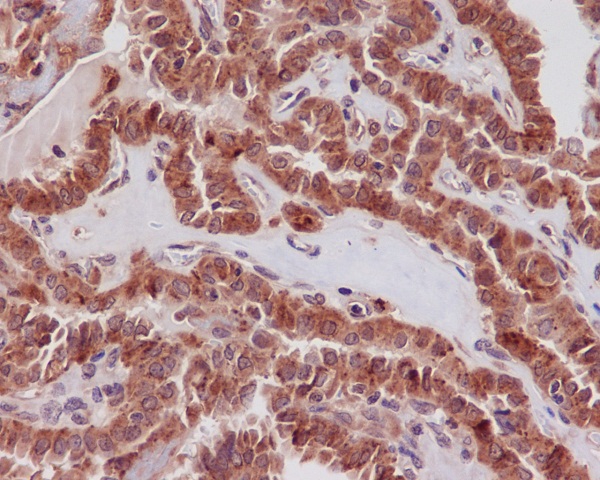 STAT3 Rabbit mAb