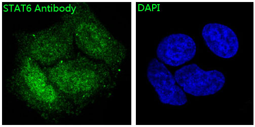 STAT6 Rabbit mAb