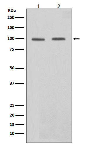 STAT6 Rabbit mAb