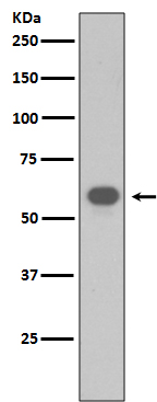 TRAF6 Rabbit mAb