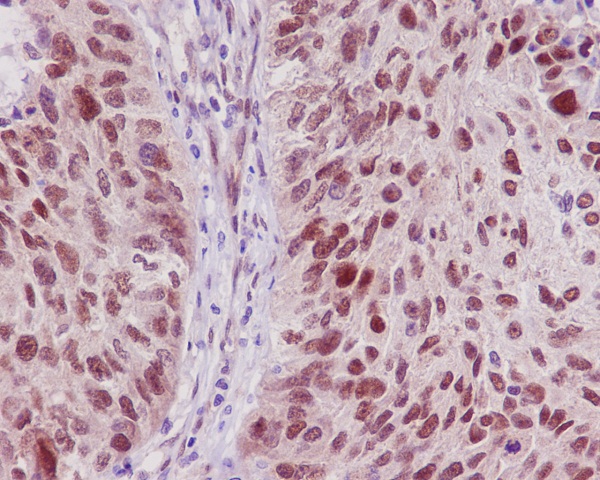 TRAF6 Rabbit mAb