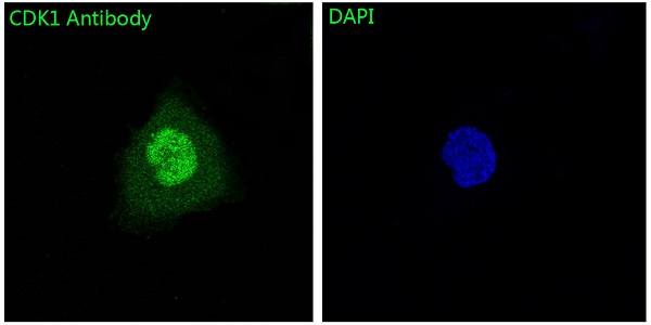 CDK1 Rabbit mAb