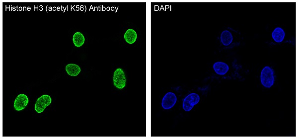 Histone H3 (acetyl K56) Rabbit mAb