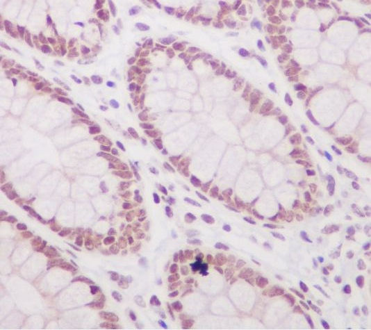 Histone H3 (acetyl K56) Rabbit mAb