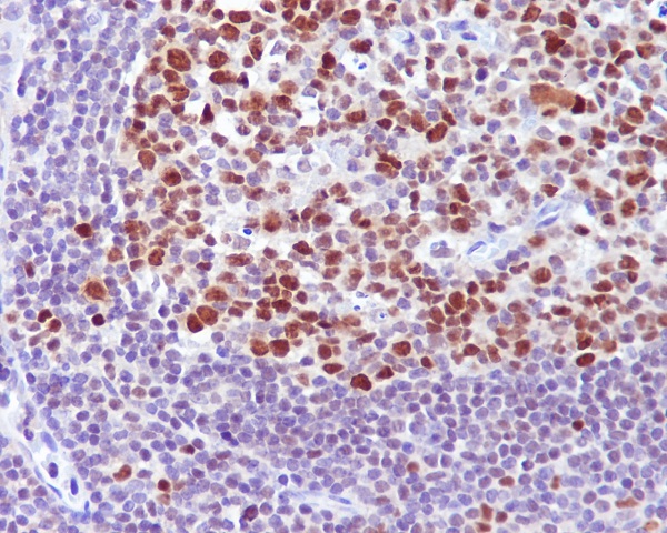 Bcl-6 Rabbit mAb