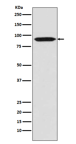 Bcl-6 Rabbit mAb