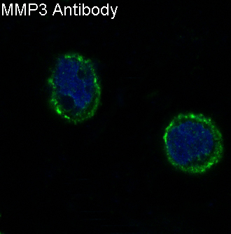 MMP3 Rabbit mAb