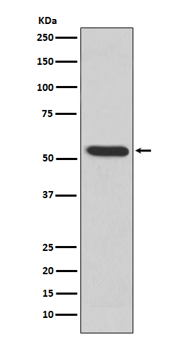 MMP3 Rabbit mAb