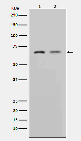 MMP2 Rabbit mAb