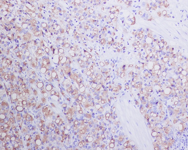 PSMA Rabbit mAb