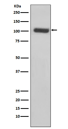 PSMA Rabbit mAb