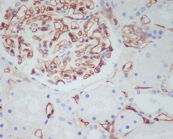 CD34 Rabbit mAb