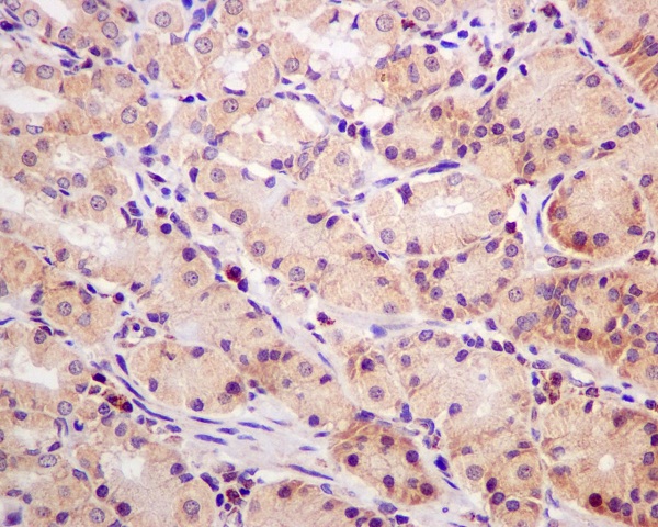 MCL1 Rabbit mAb