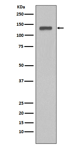 MCM2 Rabbit mAb