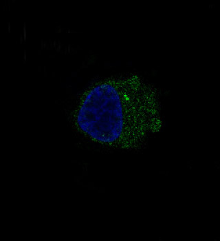 S100B Rabbit mAb