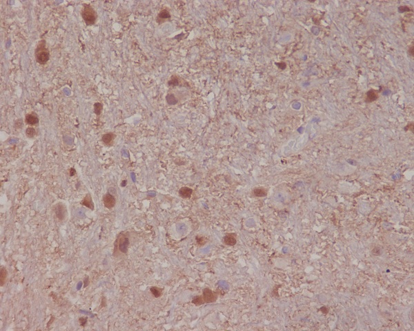 S100B Rabbit mAb