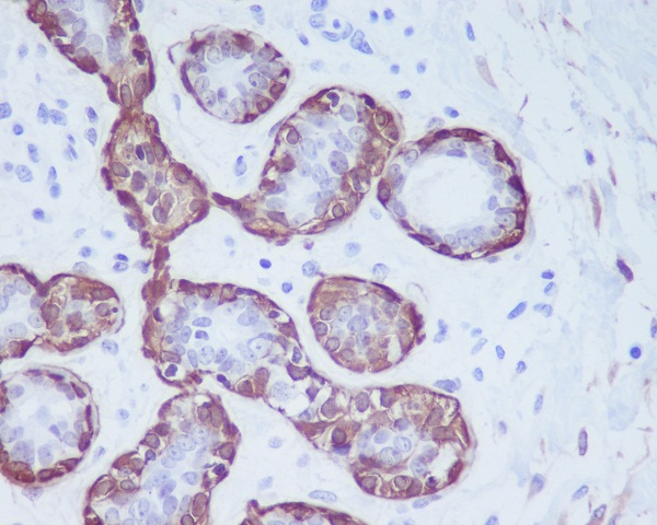 Calponin  Rabbit mAb