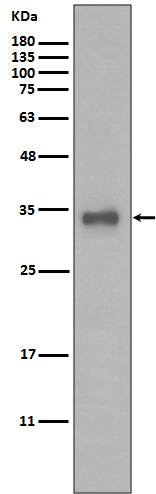 Calponin  Rabbit mAb