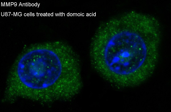 MMP9 Rabbit mAb