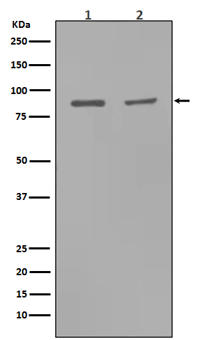 MMP9 Rabbit mAb