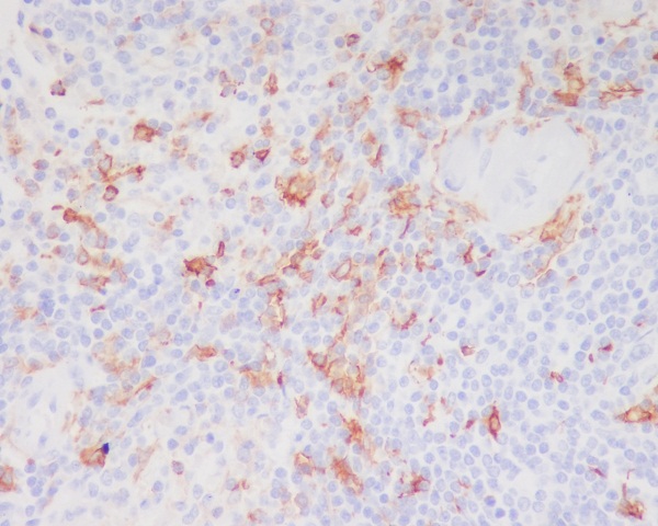 CD11c Rabbit mAb