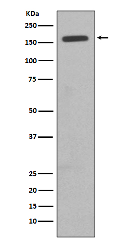 CD11b Rabbit mAb