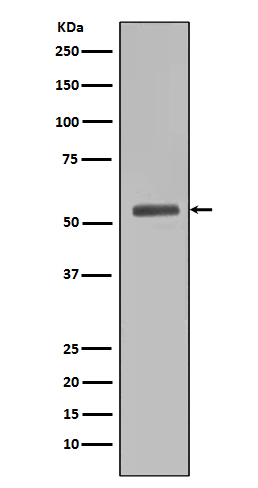 Smad5 Rabbit mAb