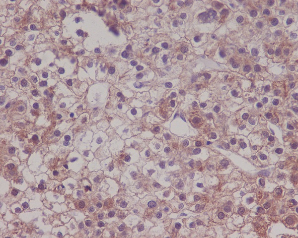 LRP1 Rabbit mAb