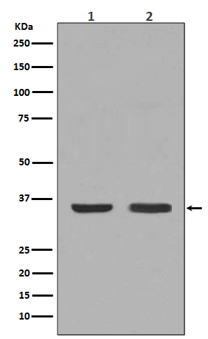 NGF Rabbit mAb