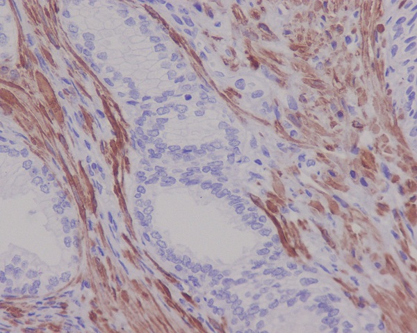 Desmin Rabbit mAb