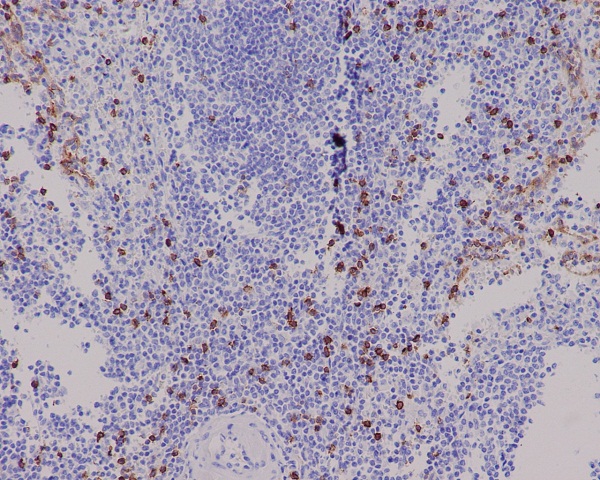 CD8 alpha Rabbit mAb