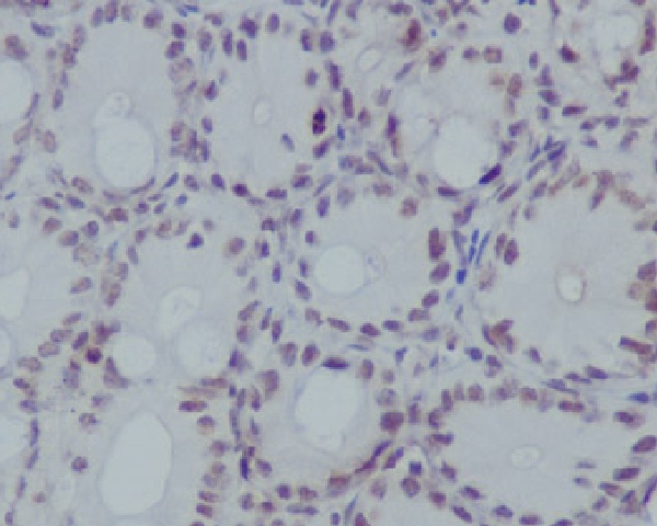 Histone H3 (mono methyl R17) Rabbit mAb