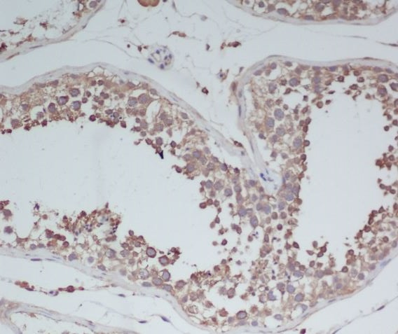 BDNF Rabbit mAb  