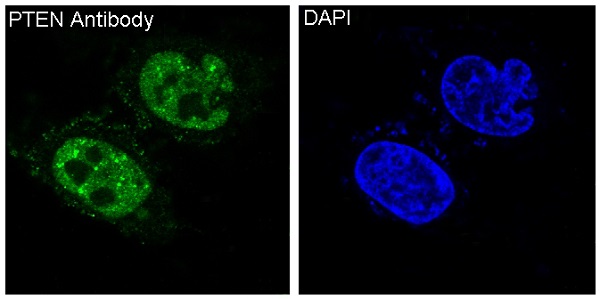 PTEN Rabbit mAb   