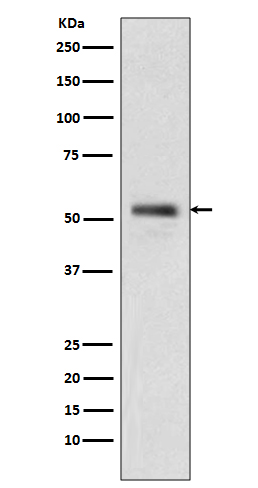 PTEN Rabbit mAb   