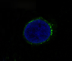 Met (c-Met) Rabbit mAb 