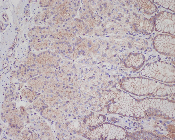 Met (c-Met) Rabbit mAb 