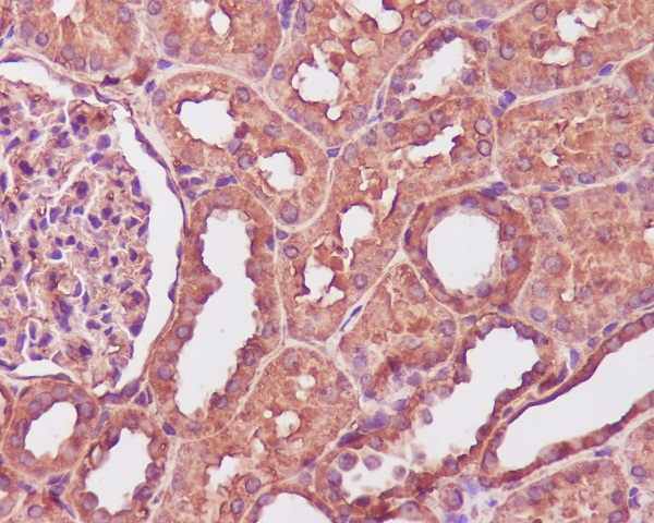 Calmodulin Rabbit mAb  