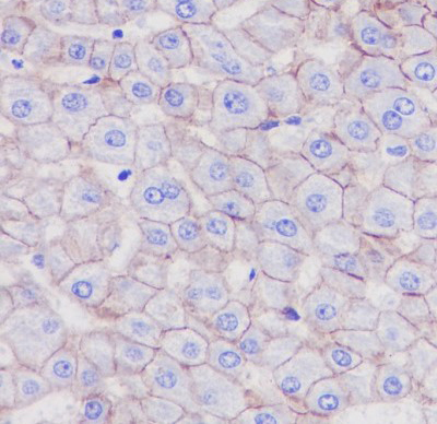 LDL Receptor Rabbit mAb 