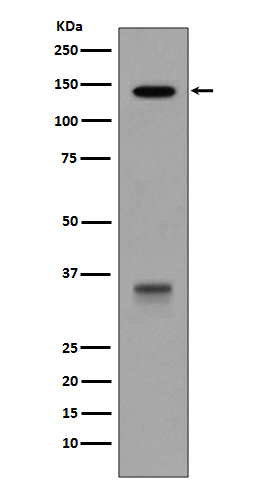 LDL Receptor Rabbit mAb 