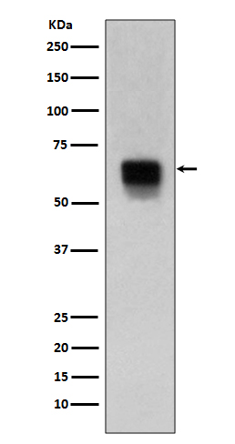 MMP14 Rabbit mAb 