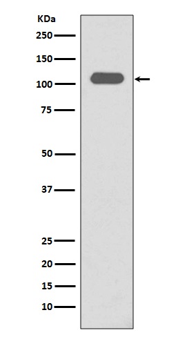 Integrin beta 3 Rabbit mAb 