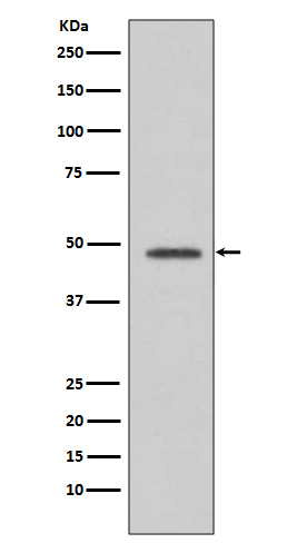 VASP Rabbit mAb 